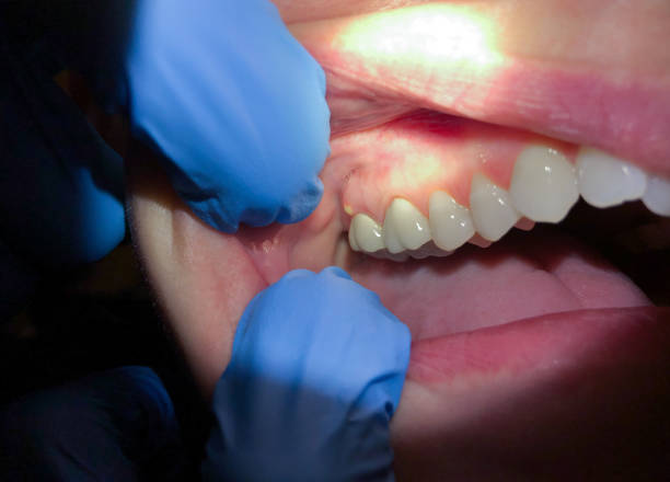 Best Emergency Cosmetic Dentistry in Mendota, IL